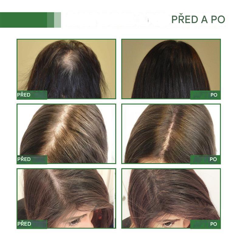 Coeurva batana vlasový olej – Péče proti vypadávání vlasů vhodná pro řídké vlasy, pro všechny typy vlasů, vhodná pro muže i ženy🎉druhý kus za poloviční cenu🔥