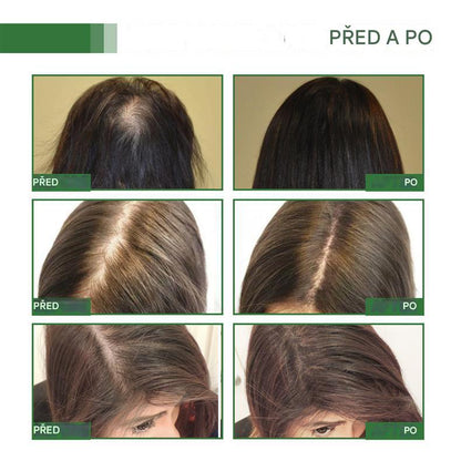 Coeurva batana vlasový olej – Péče proti vypadávání vlasů vhodná pro řídké vlasy, pro všechny typy vlasů, vhodná pro muže i ženy🎉druhý kus za poloviční cenu🔥