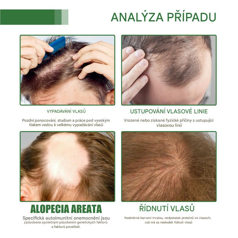 Coeurva batana vlasový olej – Péče proti vypadávání vlasů vhodná pro řídké vlasy, pro všechny typy vlasů, vhodná pro muže i ženy🎉druhý kus za poloviční cenu🔥