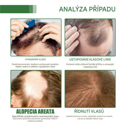 Coeurva batana vlasový olej – Péče proti vypadávání vlasů vhodná pro řídké vlasy, pro všechny typy vlasů, vhodná pro muže i ženy🎉druhý kus za poloviční cenu🔥